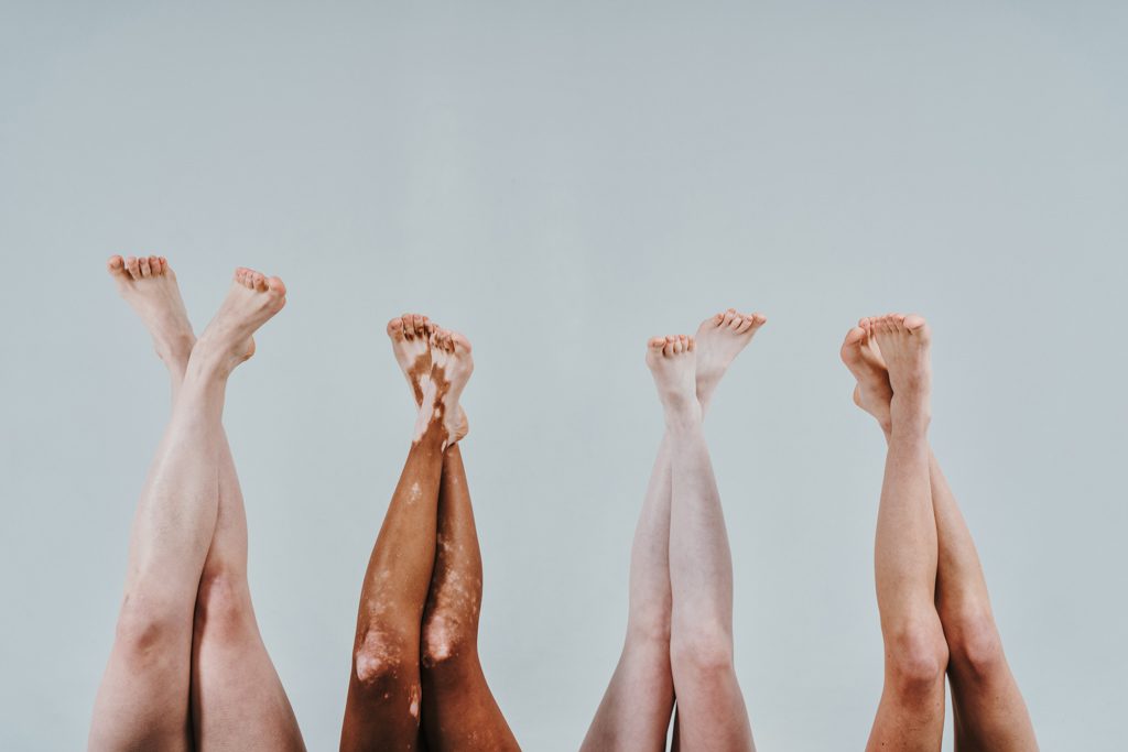 A group of multiethnic women with different kind of skin posing together in studio—legs only.