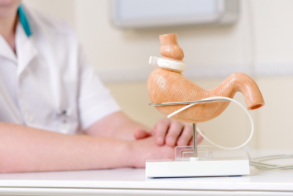 A close-up image of a gastric band placed on a replica stomach, with a doctor in the background.